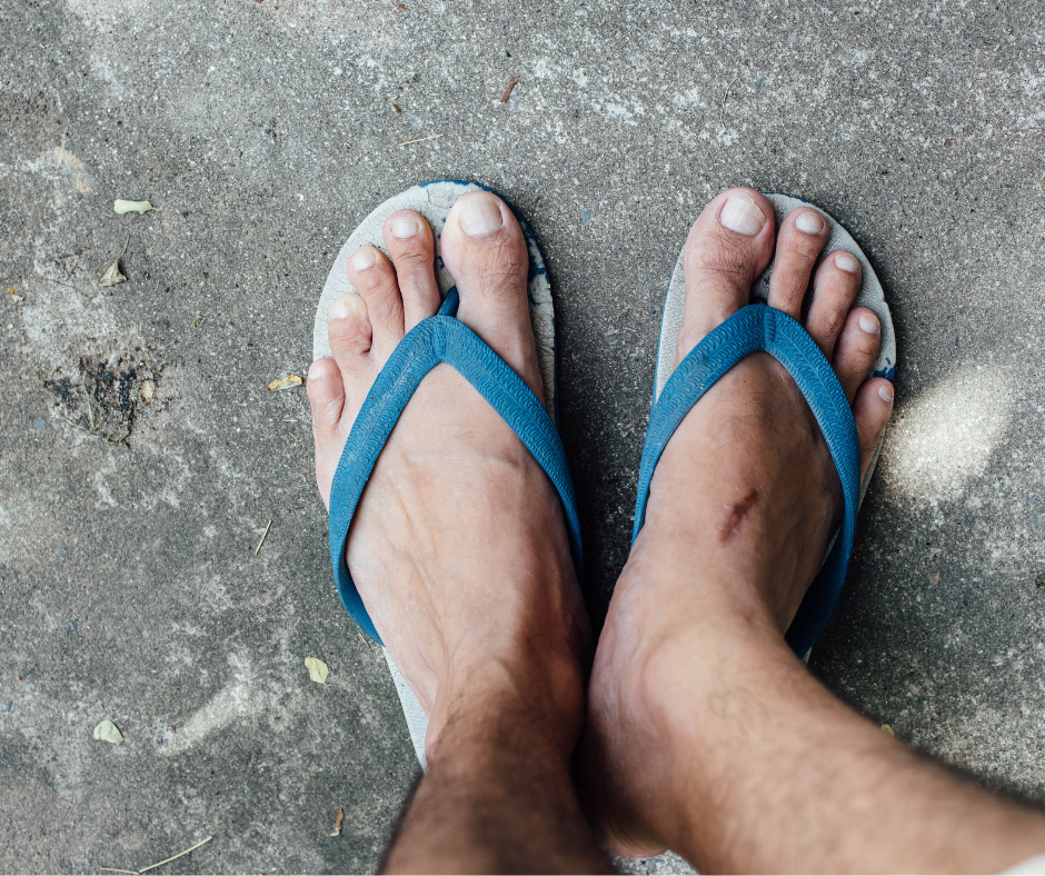 sandals on city street