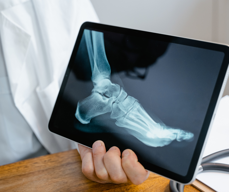 Common Myths About Foot and Ankle Injuries