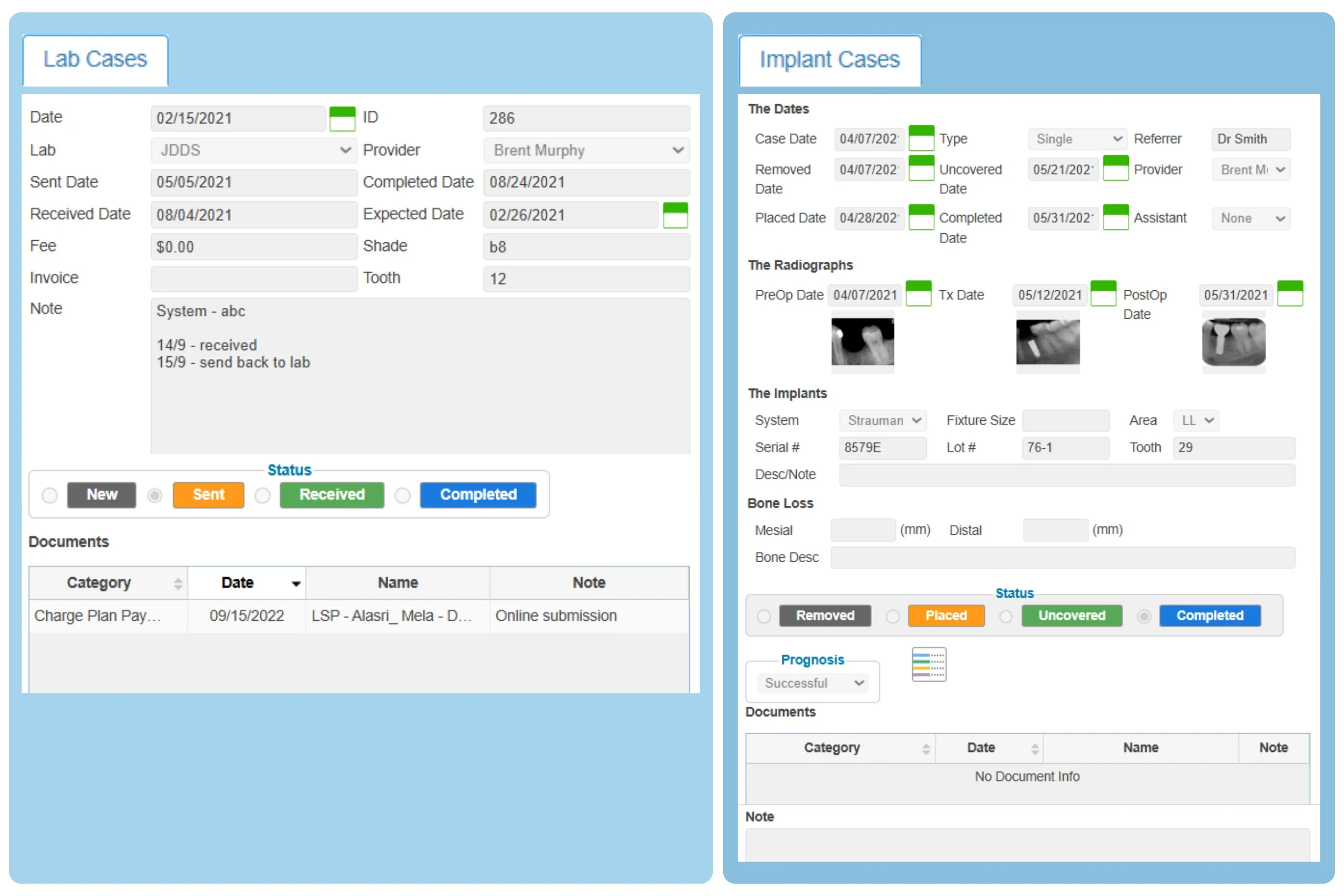 dental implant treatment planning software