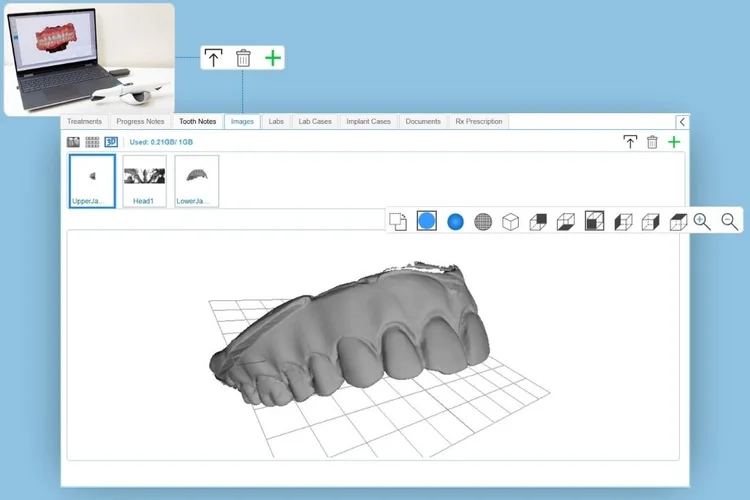 Cloud Dental 3D Imaging Software for Smarter Visualization