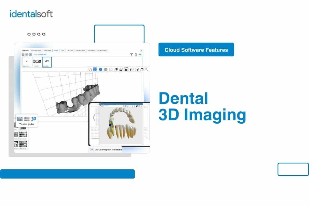 Dental 3D Imaging