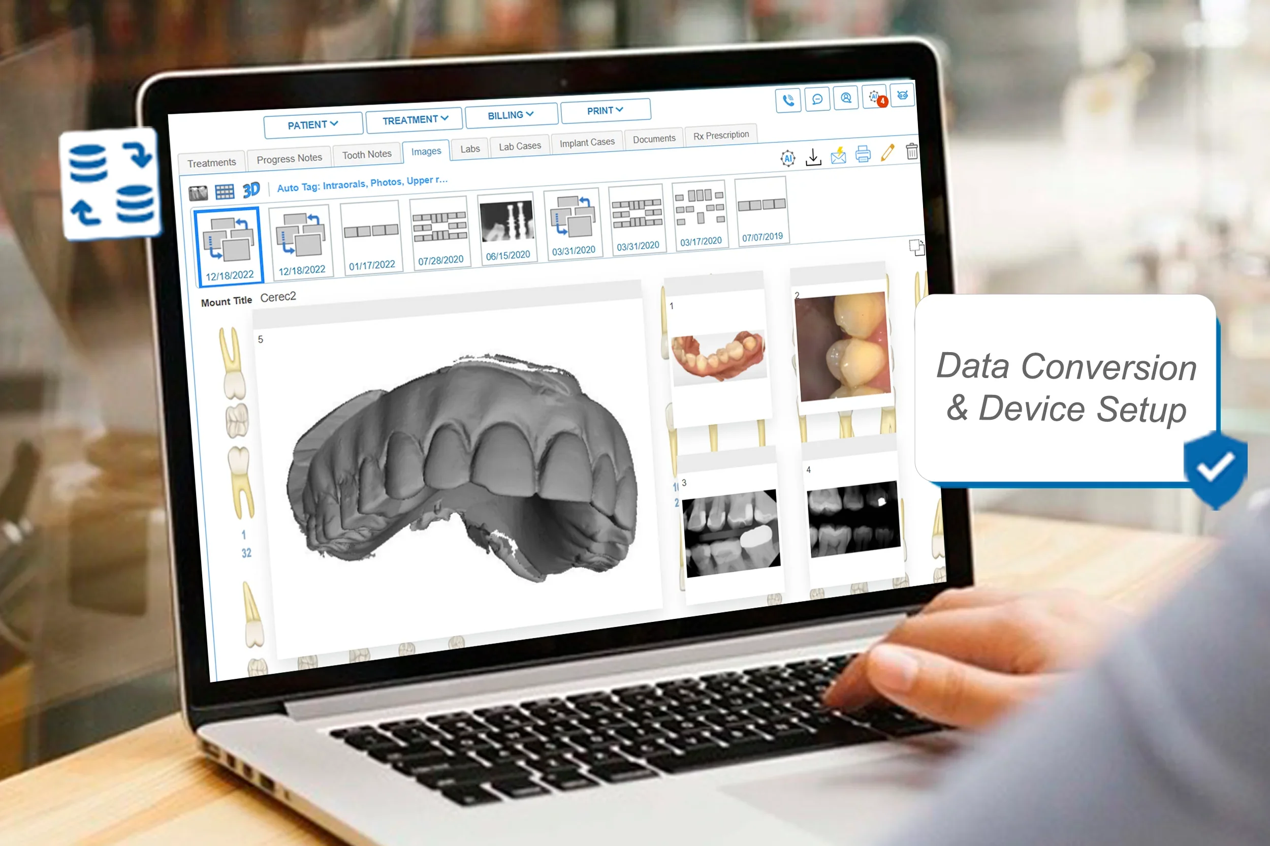 dental imaging software data conversion