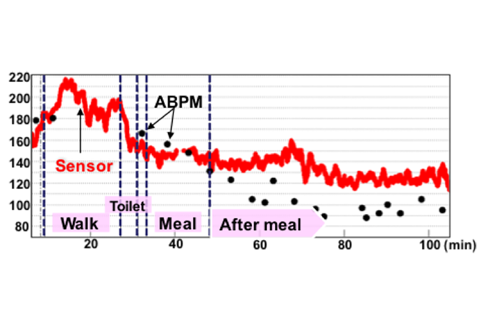 Example_of_blood_pressure_measurementpng.png