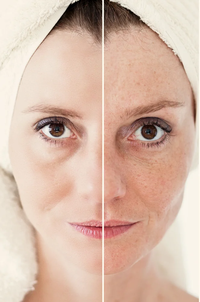 IPLPigmentation — Primrose Beauty, Laser & Aesthetic Clinic, Limerick