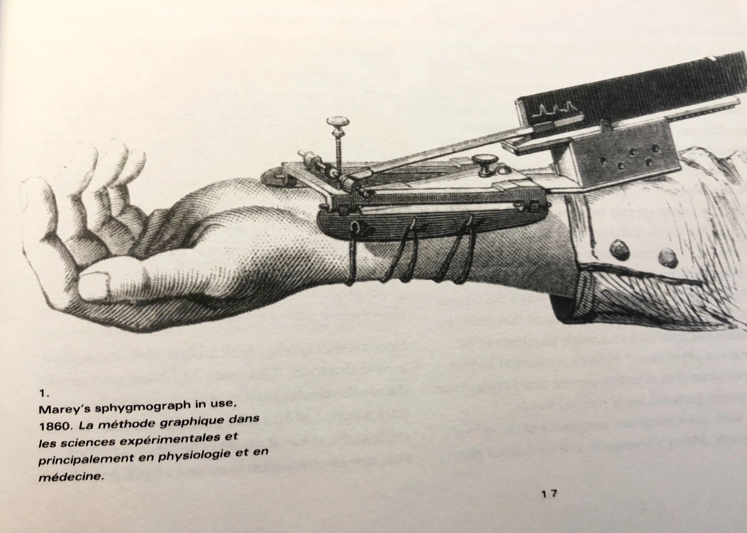 Marey _Arm.jpg