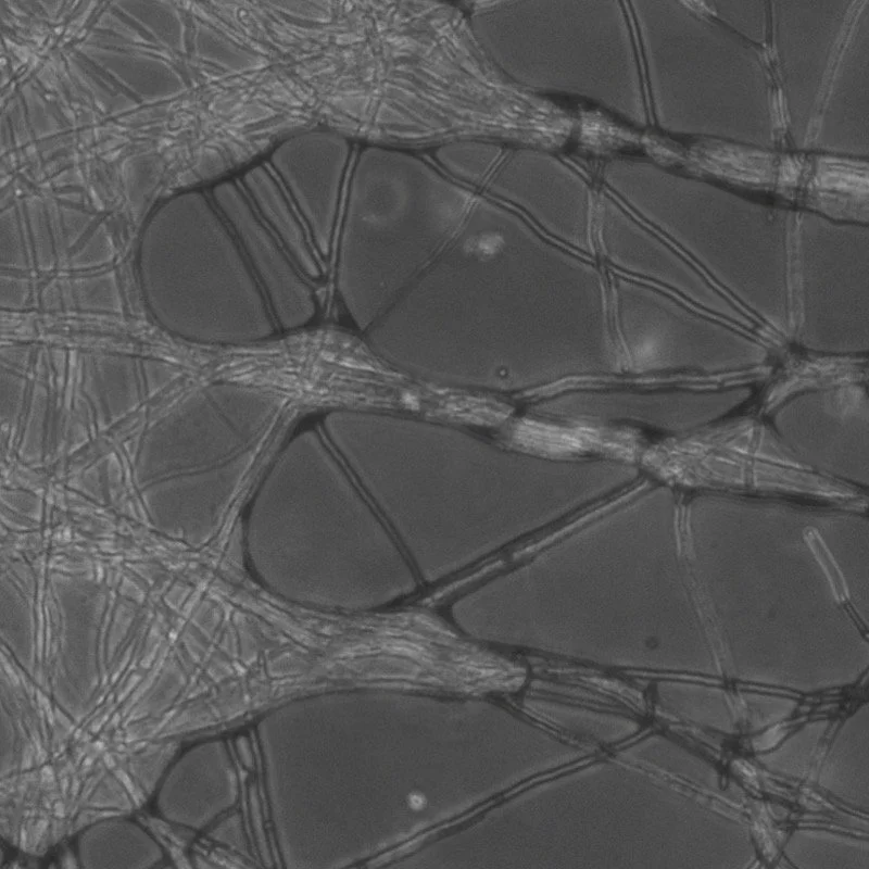 Bacteria in hyphae. Claire Stanley Lab.
