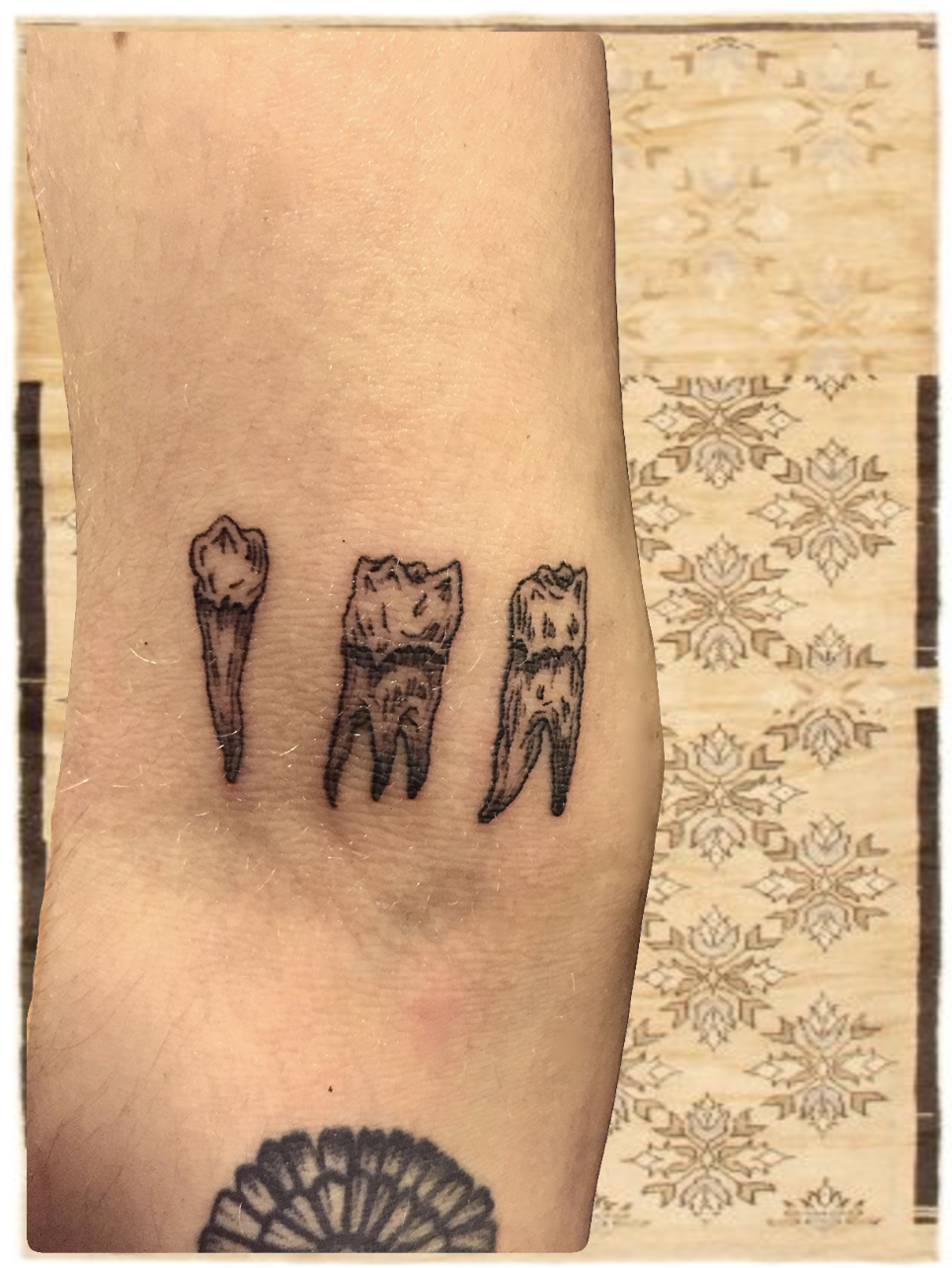 arm, teeth.png