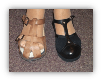 slippers for rheumatoid arthritis