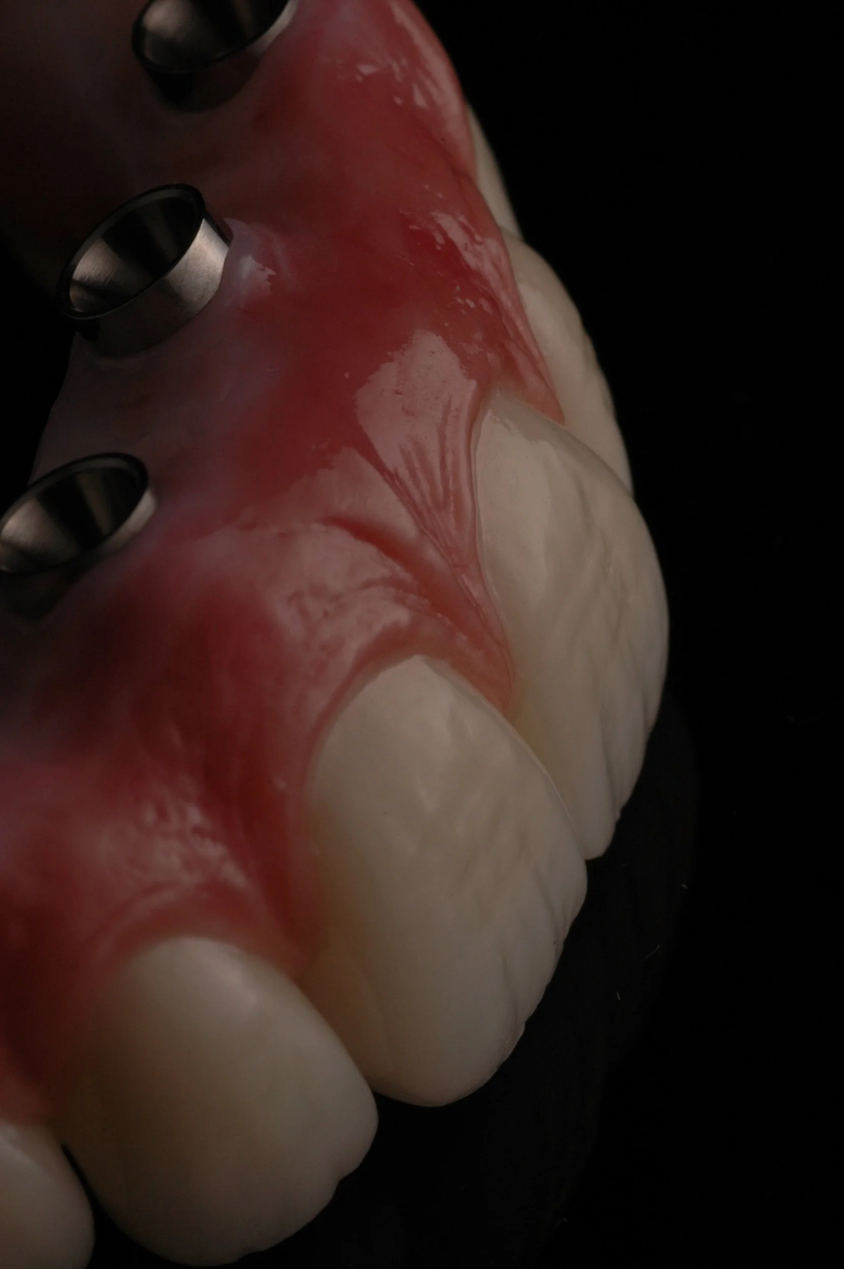 Advanced Dental Implant Solutions