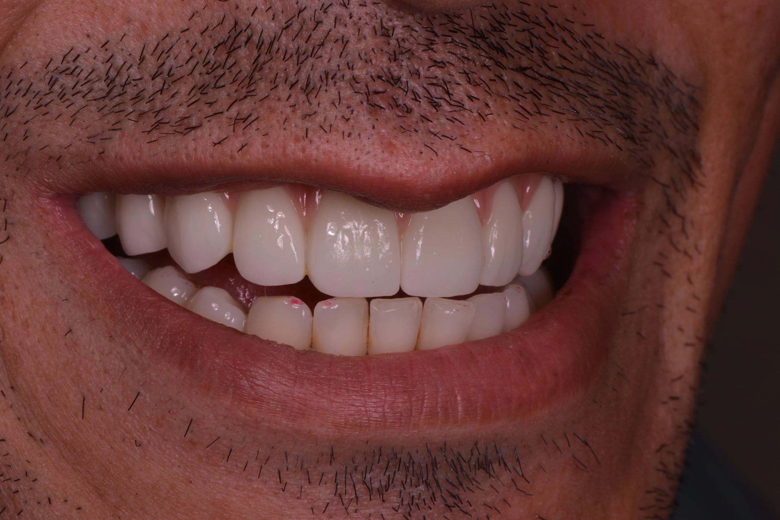 Ruiz, Joseph 109.JPG