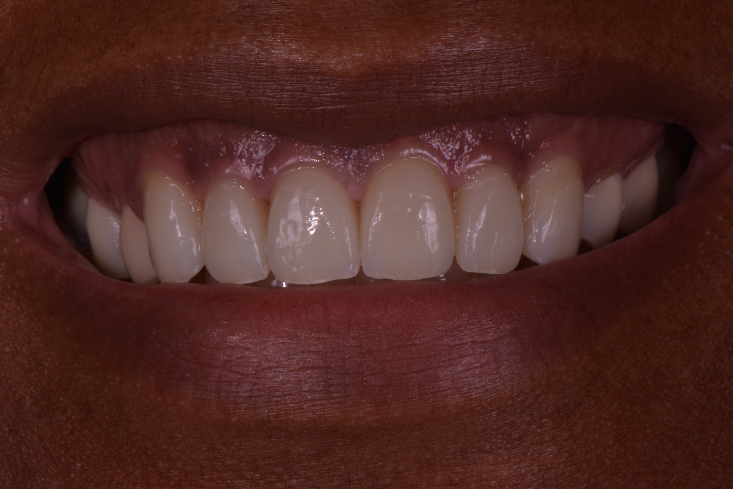 Hooper, Nicole 107.JPG