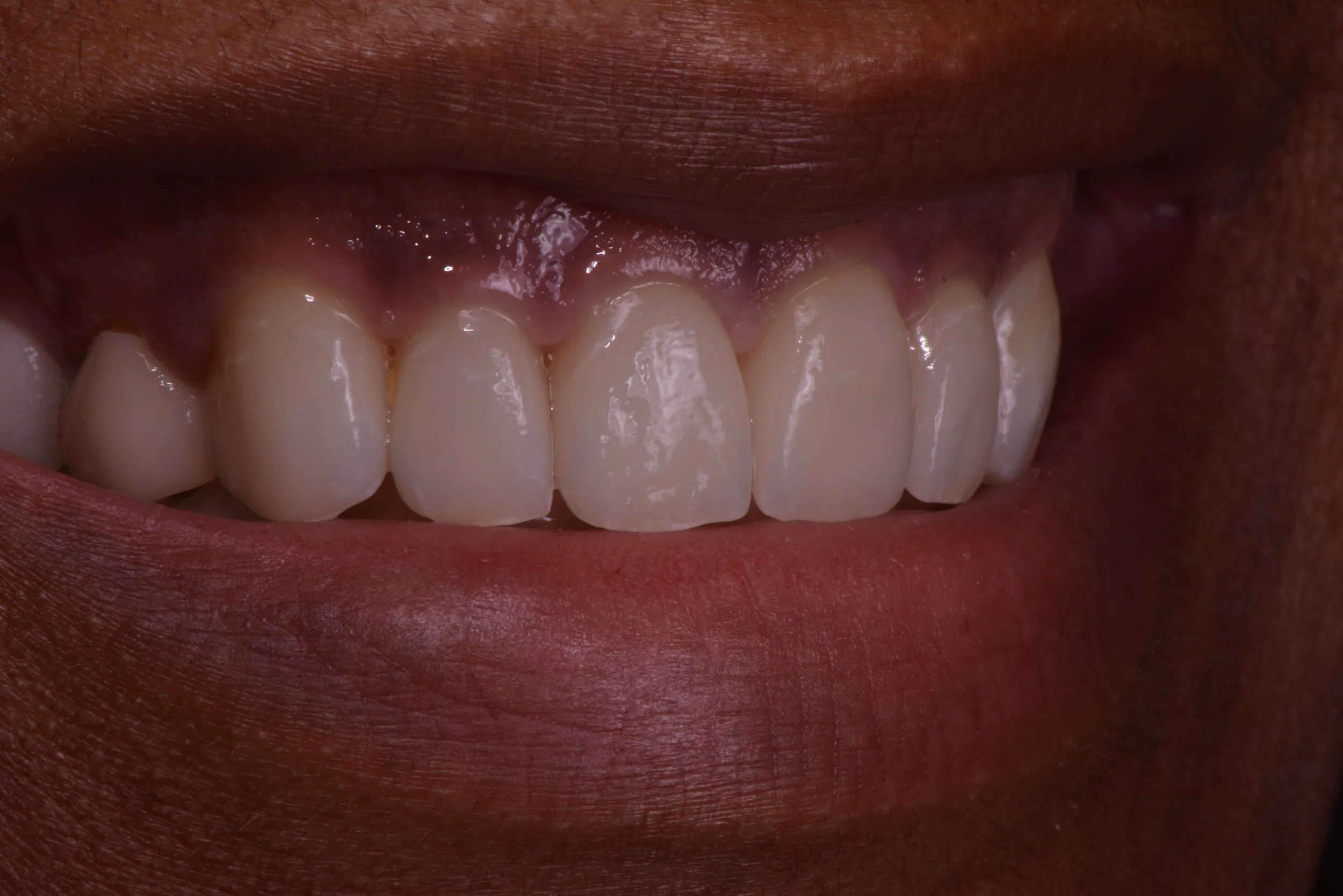 Hooper, Nicole 113.JPG