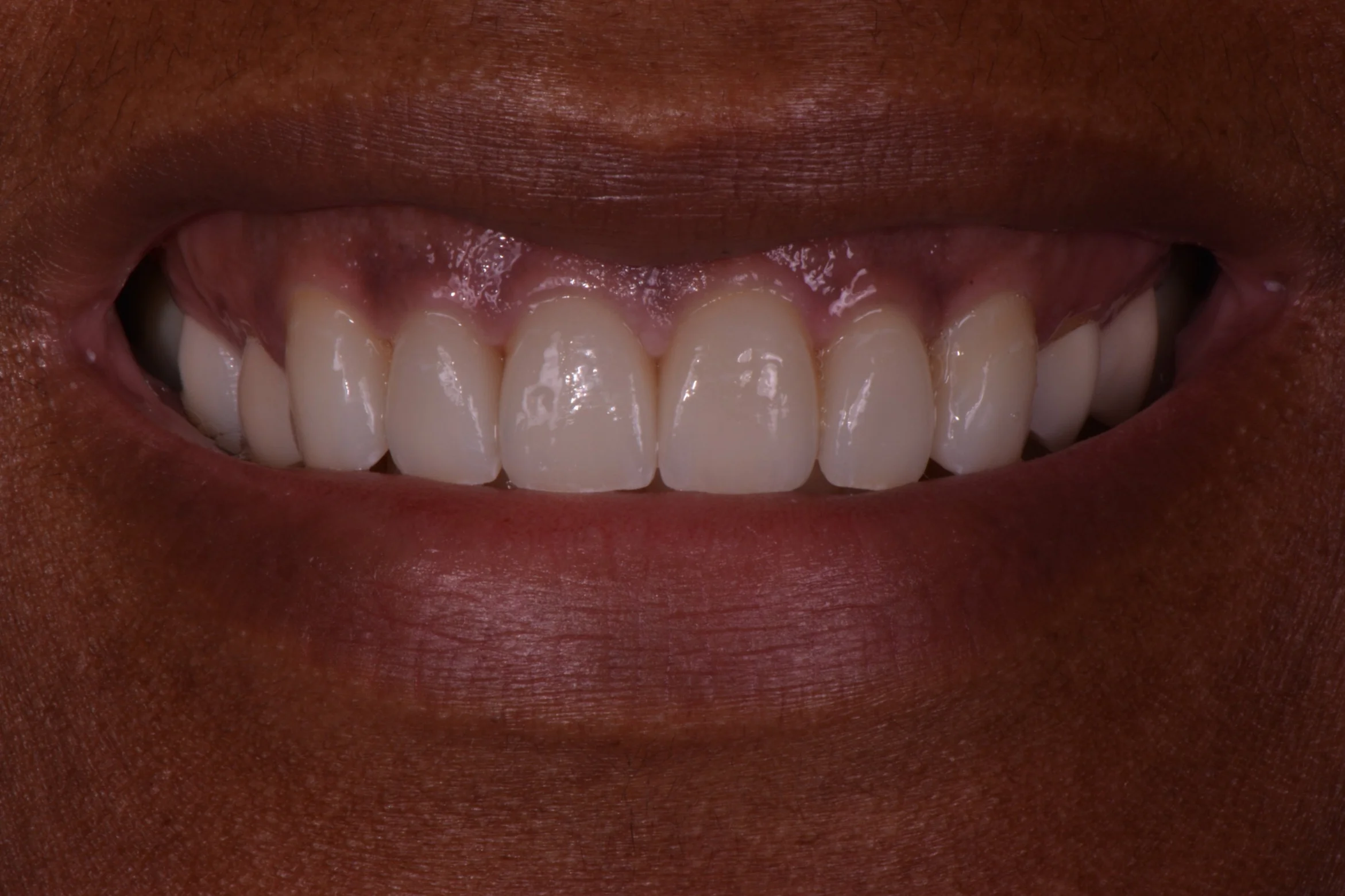 Hooper, Nicole 110.JPG