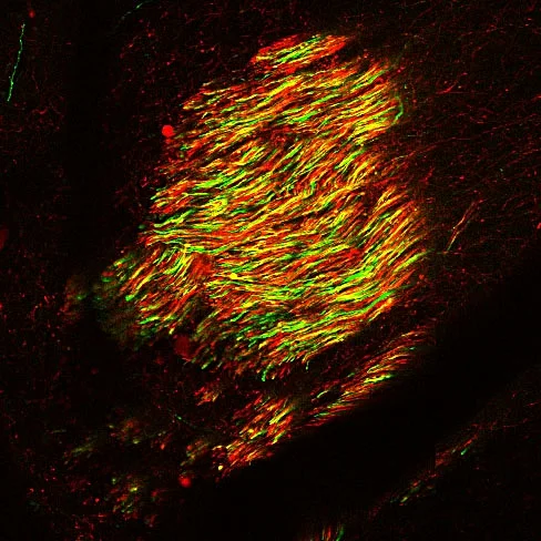 slice_383031_slide4_section2_thalamus.jpg