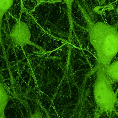 mossyCell.jpg