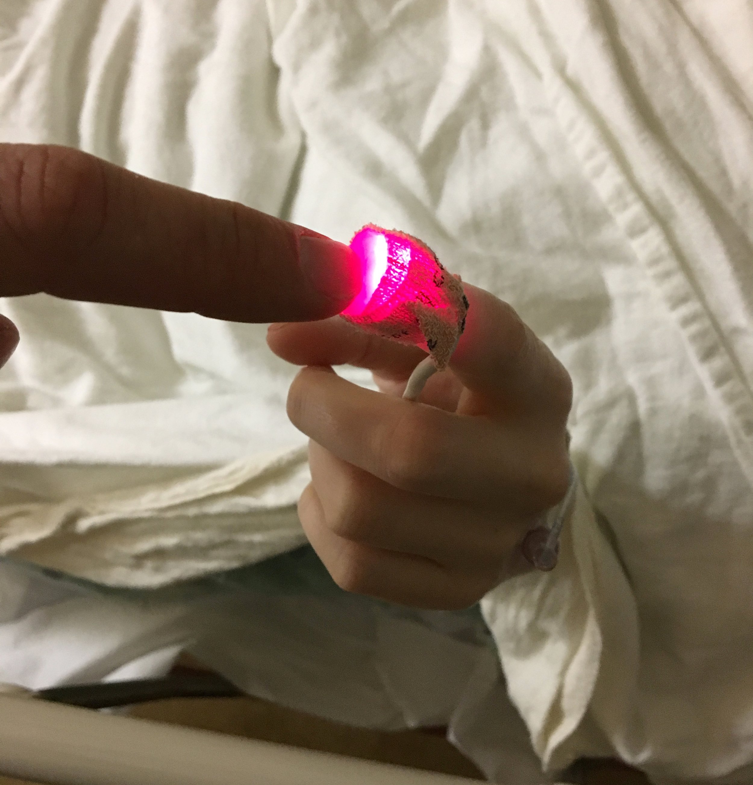 Getting Stoned, Part Four: A Foodie Goes Under the Knife