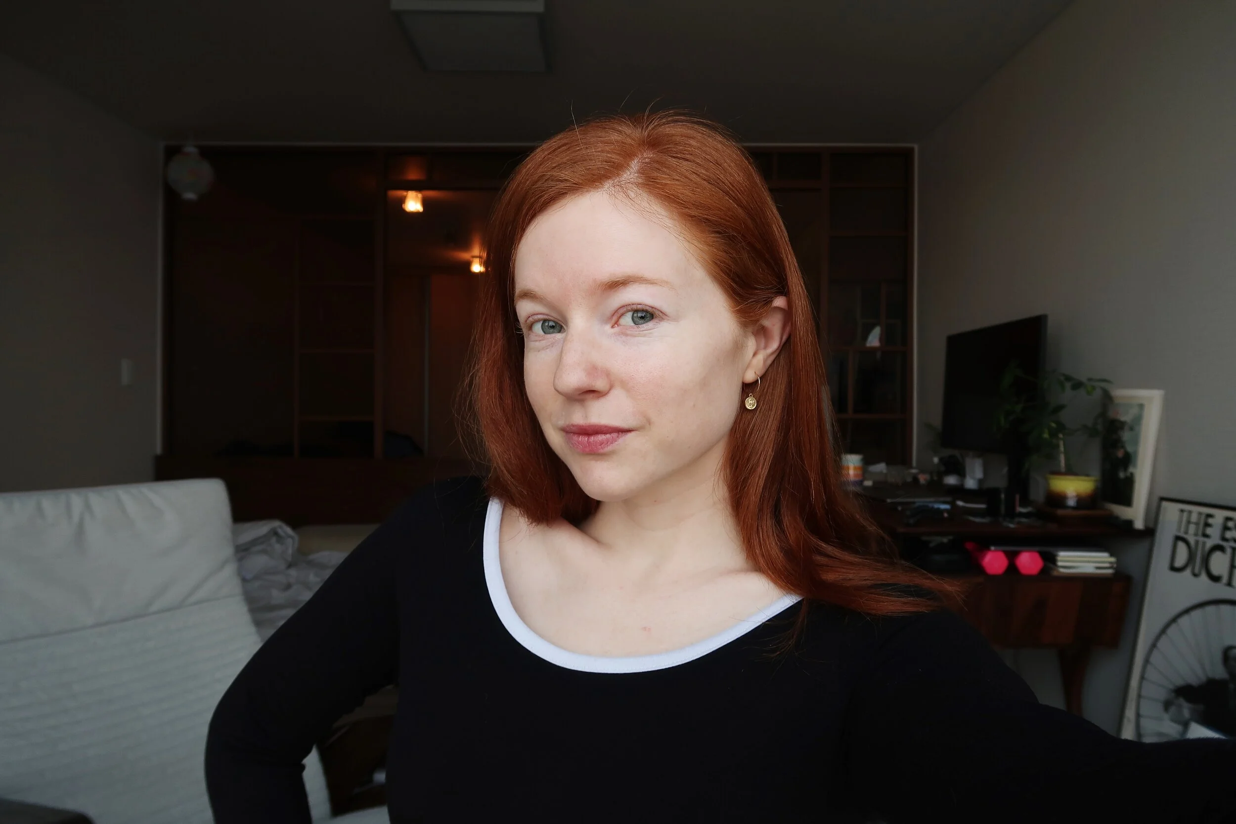 Micro-Needling RF Treatment and Aqua Peel in Seoul, Korea