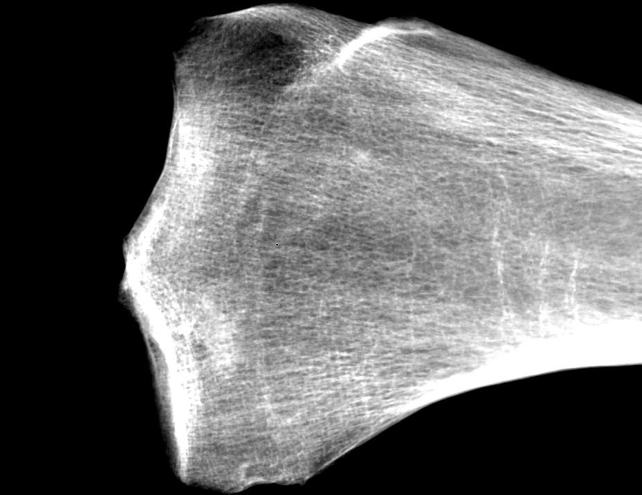 Medical Radiography