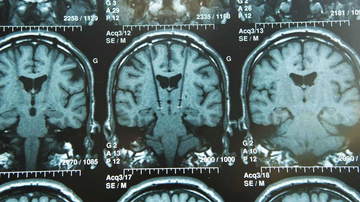 Are psychedelics undergoing a spiritual and therapeutic awakening?