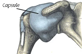Capsulitis.jpg
