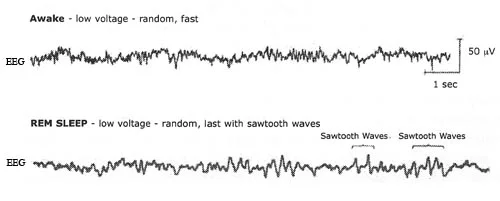 awake-vs-rem-sleep-brain-activity.jpg
