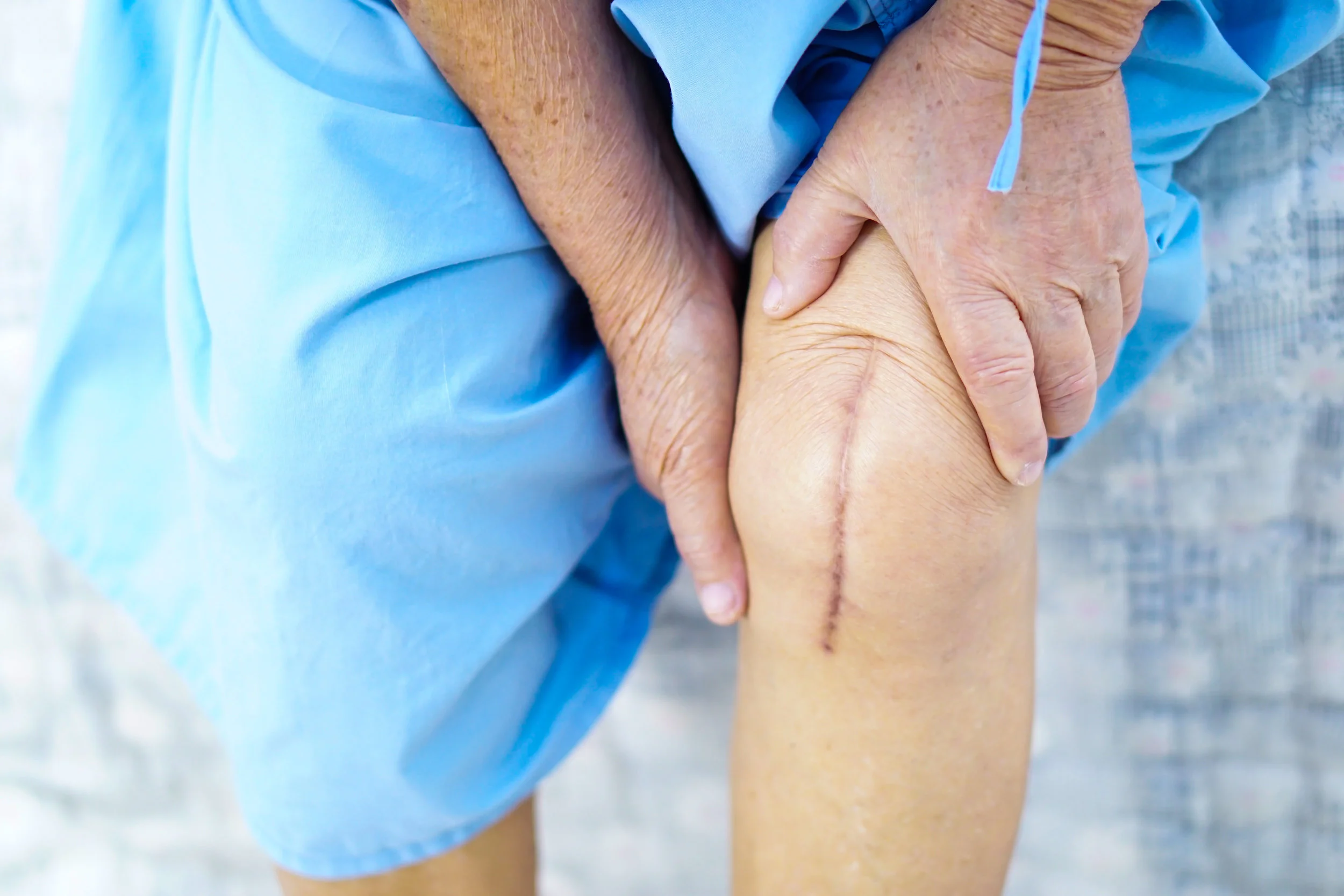 Total Knee post op.jpeg