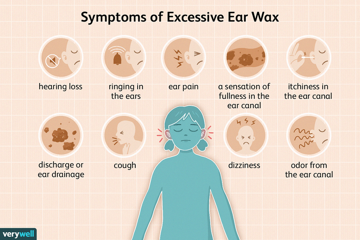 The Ultimate Guide to Safe Ear Wax Removal at Home