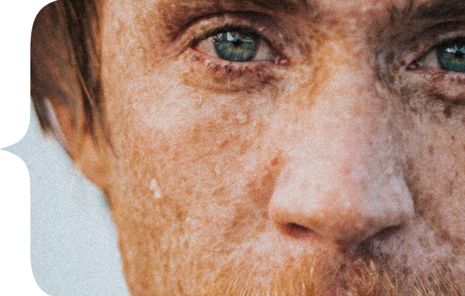 freckles.png