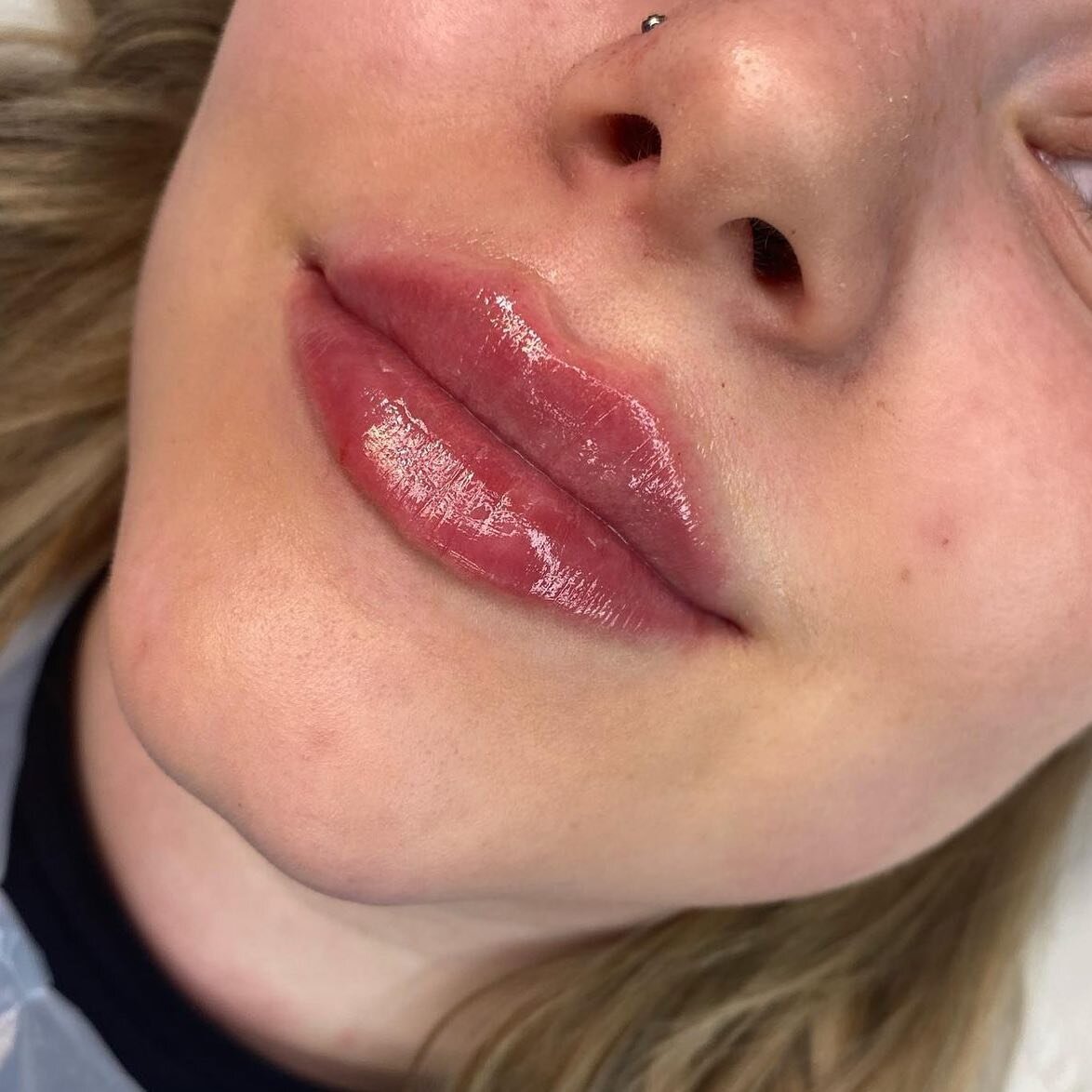 How beautiful are these lips😍 

Perfectly enhanced by @portianancyaesthetics 💖 Portias next clinic date In CAERNARFON is next Wednesday the 23rd of June! For more information on treatments or to book Dm @portianancyaesthetics 💖