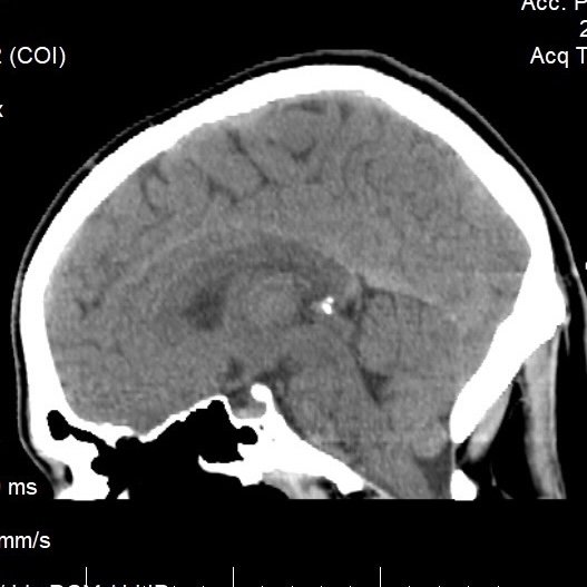 CT-scan-TNJ.jpeg