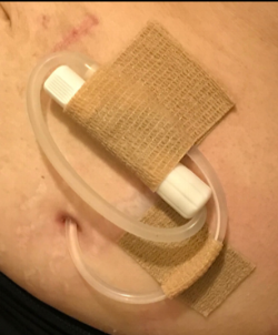 CATHY-MATE 1 and II Picture on Body.png