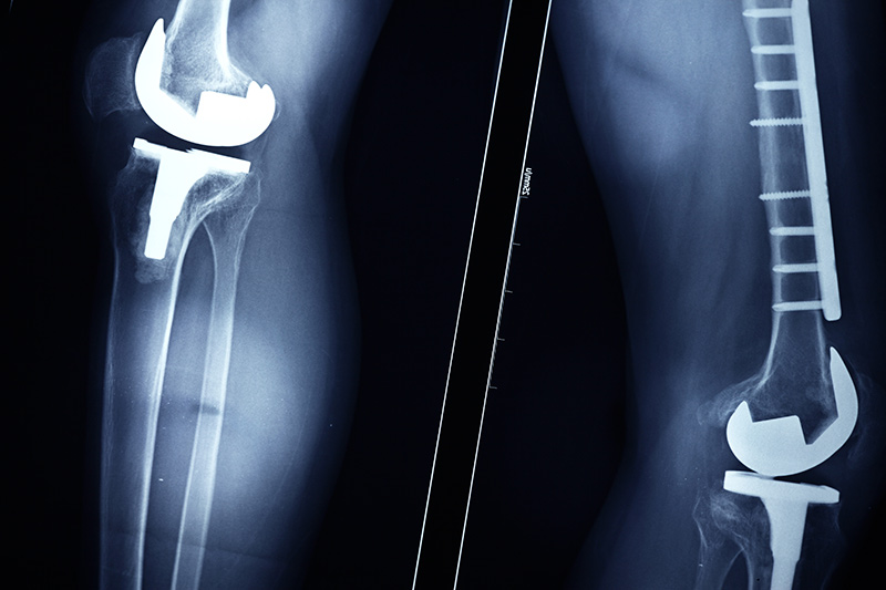 defective-medical-devices-the-matthews-firm.jpg