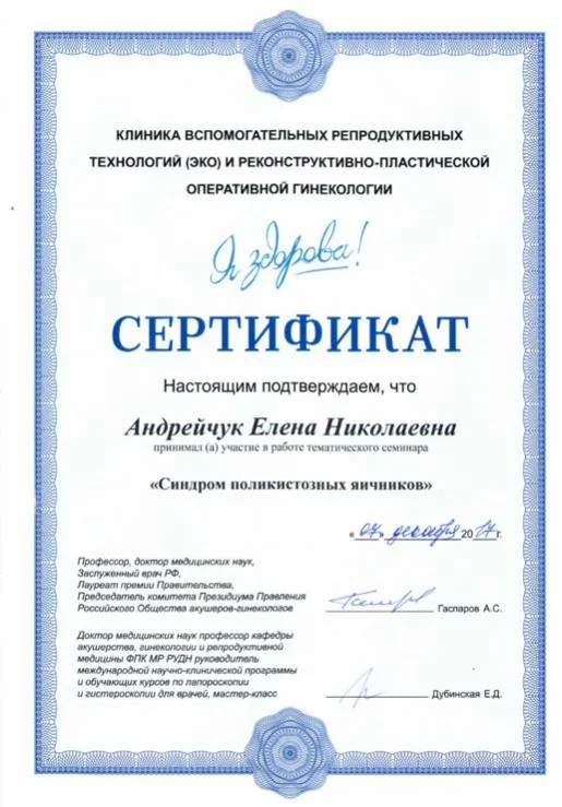 Синдром поликистозных яичников