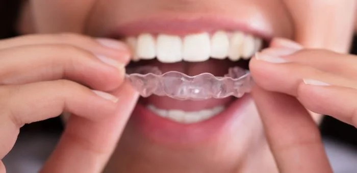 Капы от бруксизма