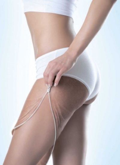 Лазерное лечение шрамов