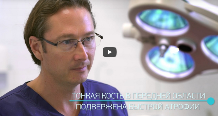 Имплантация переднего зуба