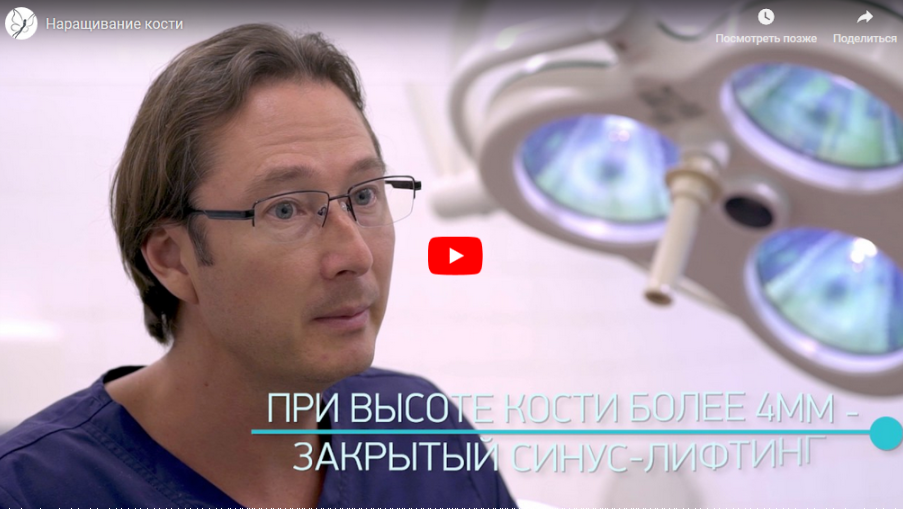 Имплантация зубов: наращивание костной ткани