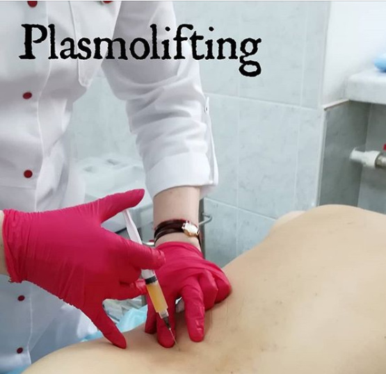 Плазмолифтинг суставов что это. Плазмолифтинг позвоночника. Плазмолифтинг для спины и суставов. Плазмолифтинг поясничного отдела позвоночника. PRP плазмолифтинг позвоночника в неврологии.