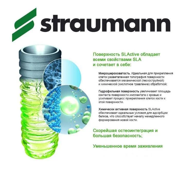 Импланты STRAUMANN - отзывы пациентов и эффективность