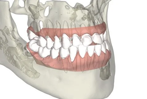 3D_Smile_teeth_movement_with_roots.001.jpg