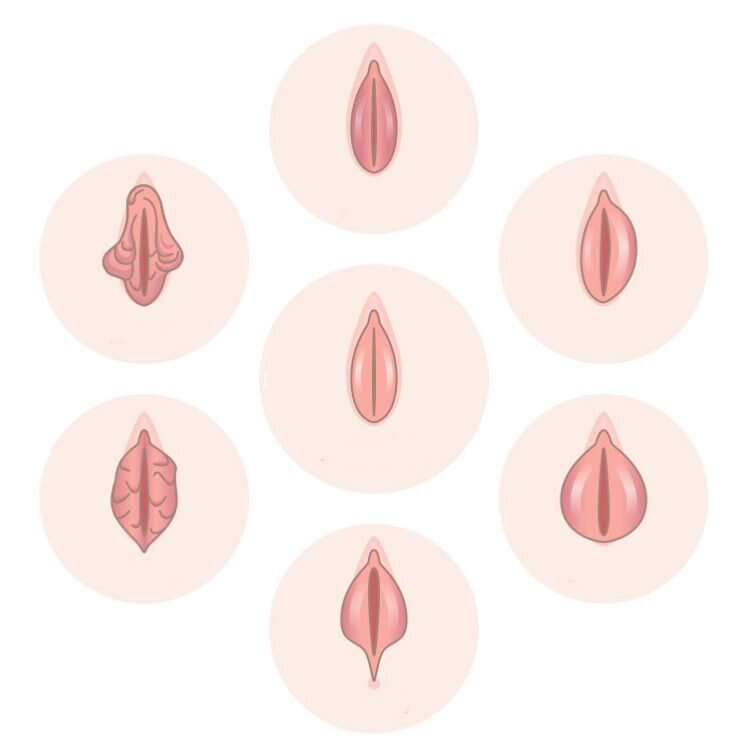 Лабиопластика – пластика половых губ