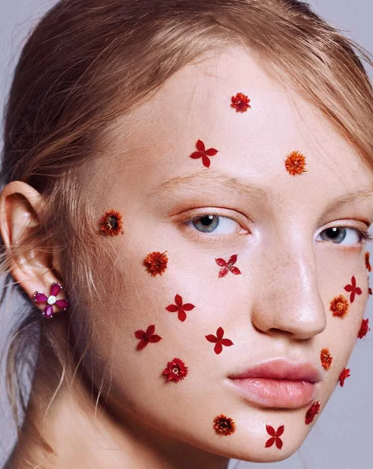 Прыщи на лице - виды акне и способы лечения