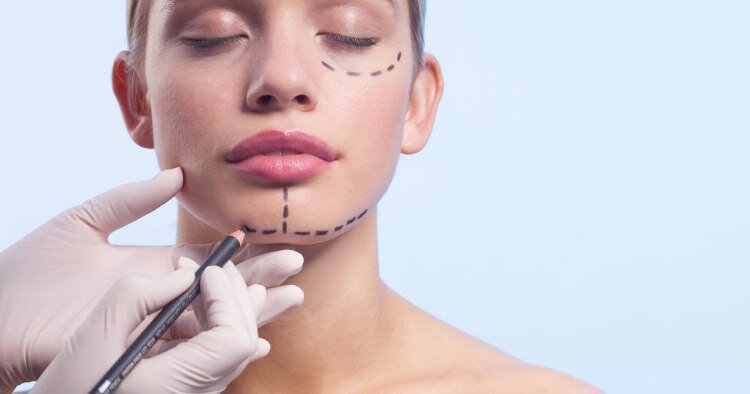 Эндоскопический лифтинг