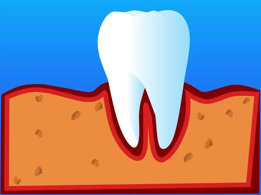Пародонтология