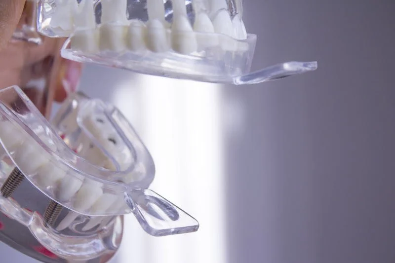 Пластиночные имплантаты