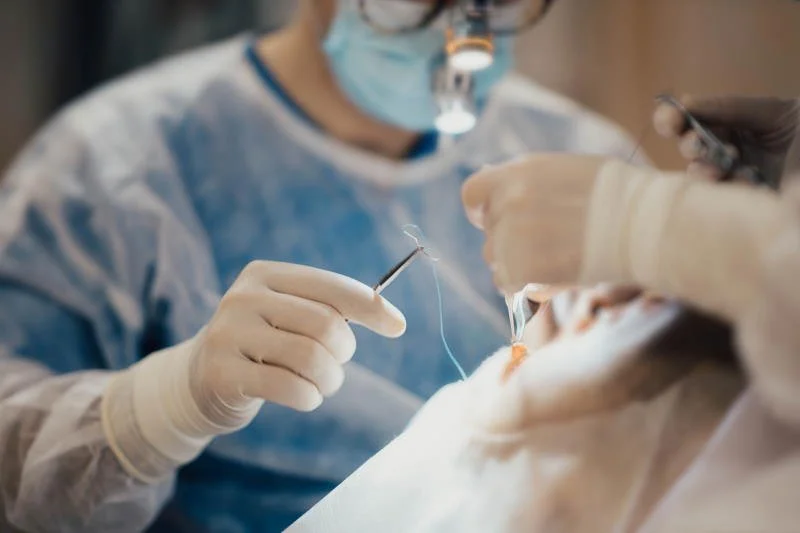 Пересадка соединительной ткани