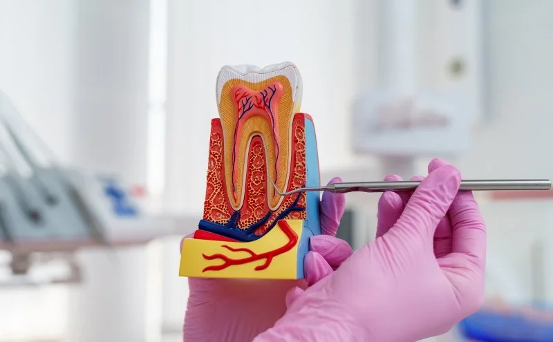 Обтурация&nbsp;корневых каналов