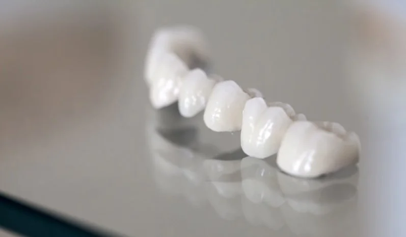 Коронка на зуб