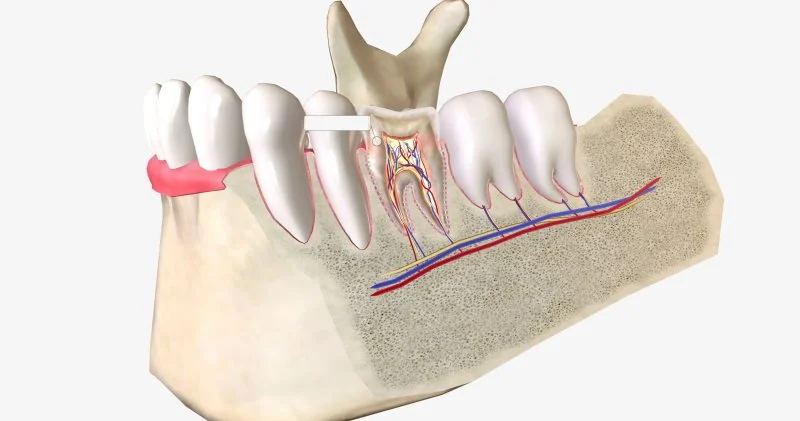 Гребень альвеолярный