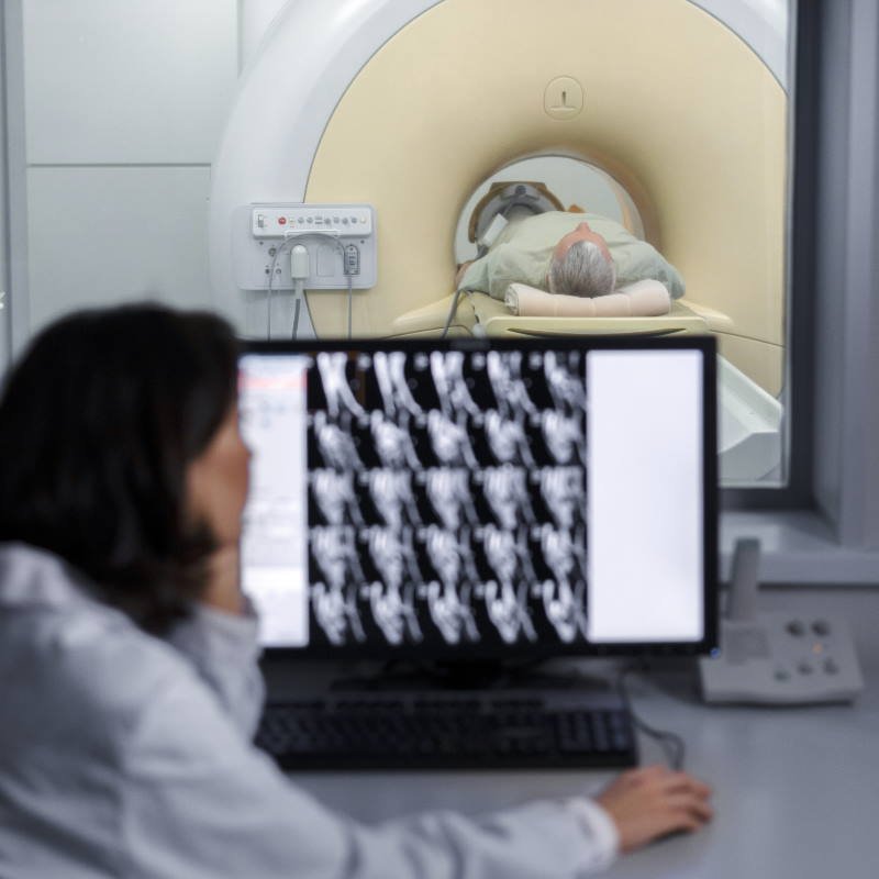 Компьютерная томография